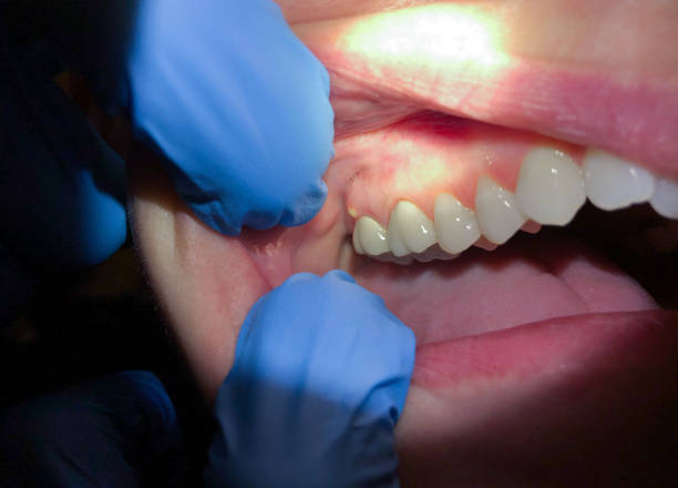 Best Emergency Dental Surgery in Decorah, IA